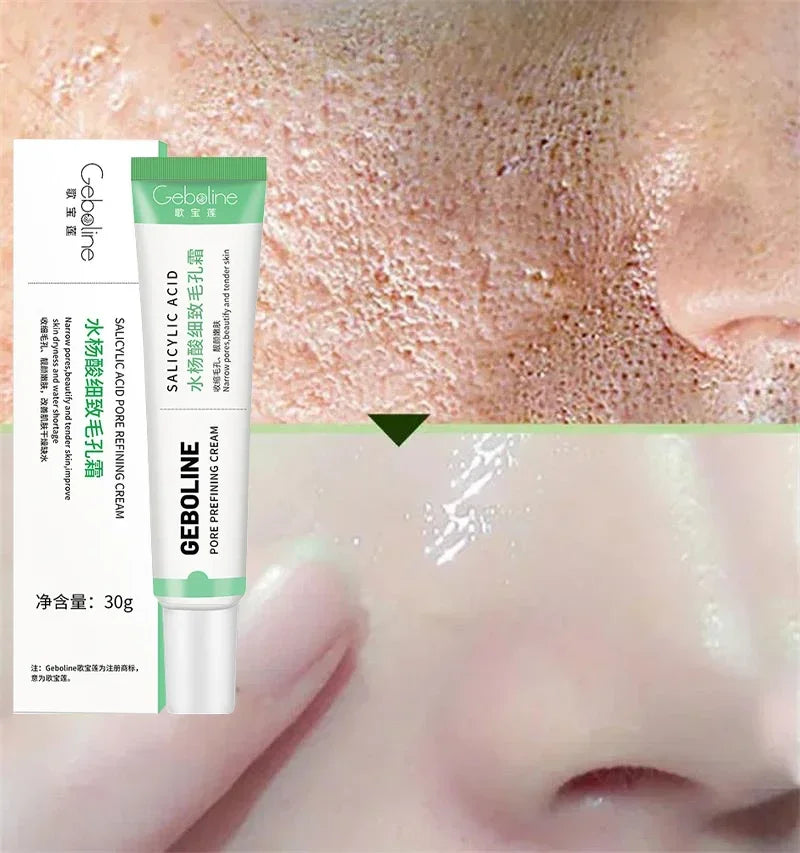 Salicylic Acid Pore Refining Cream - Acne Scar & Blackhead Treatment