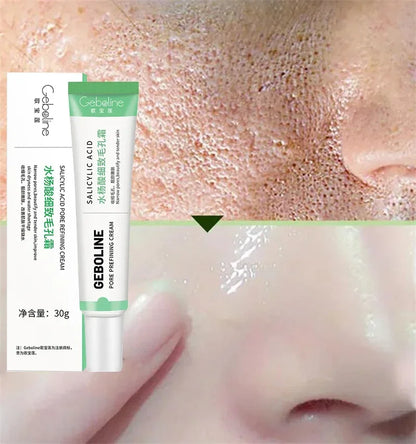 Salicylic Acid Pore Refining Cream - Acne Scar & Blackhead Treatment