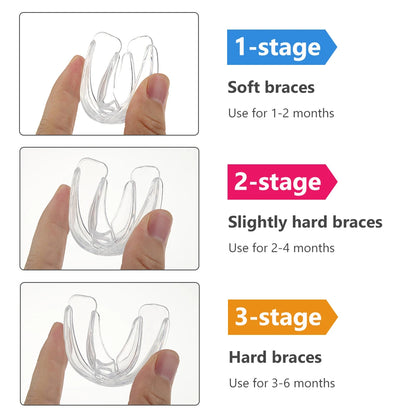3-Stage Dental Orthodontic Alignment Trainer for Kids Teeth Straightening