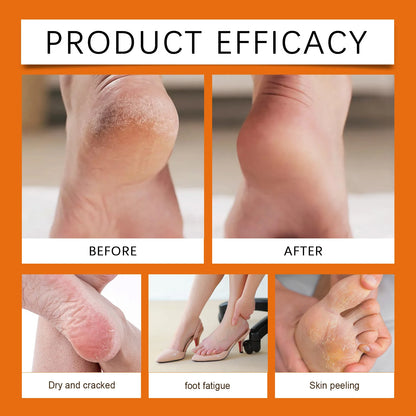 Honey Extract Moisturizing Heel Balm for Dry Cracked Skin Repair
