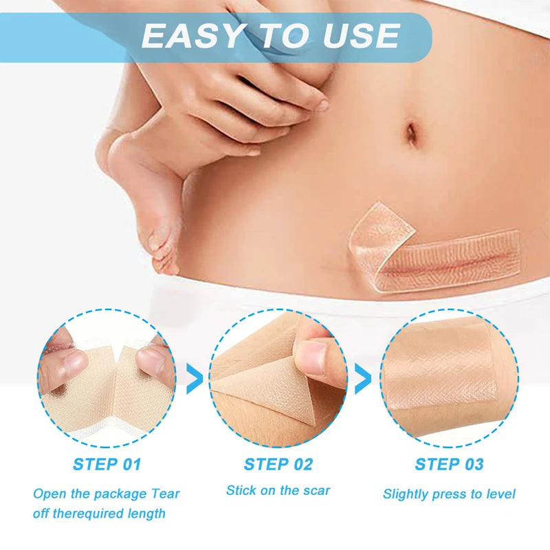 Silicone Scar Removal Tape - Waterproof, Reusable Adhesive Gel Sheet for Scar Repair