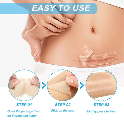 Silicone Scar Removal Tape - Waterproof, Reusable Adhesive Gel Sheet for Scar Repair