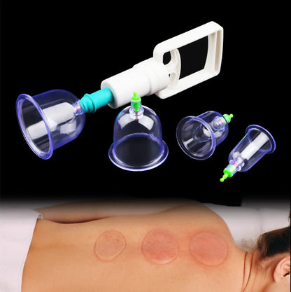 6-Cup Vacuum Cupping Therapy Set with Hand Pump