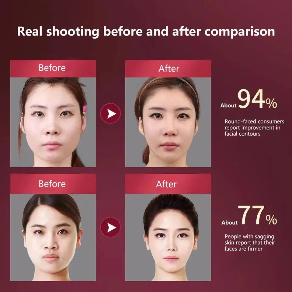 LED V-Face Lifting Massager: Photon Therapy & Vibration Slimming Device