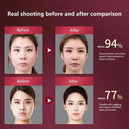 LED V-Face Lifting Massager: Photon Therapy & Vibration Slimming Device