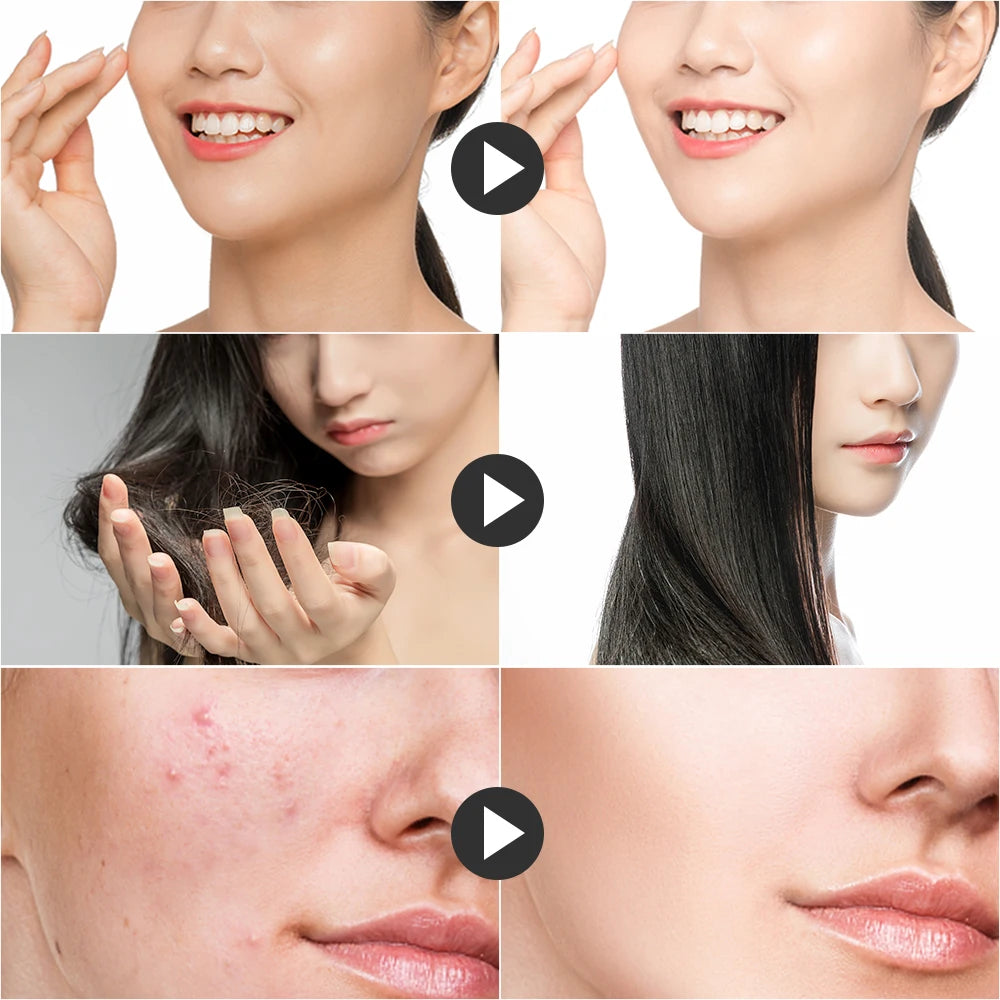 4-in-1 High Frequency Facial Therapy Wand for Acne