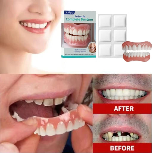 Cosmetic Smile Veneers - Comfortable Upper & Lower Natural Look Teeth