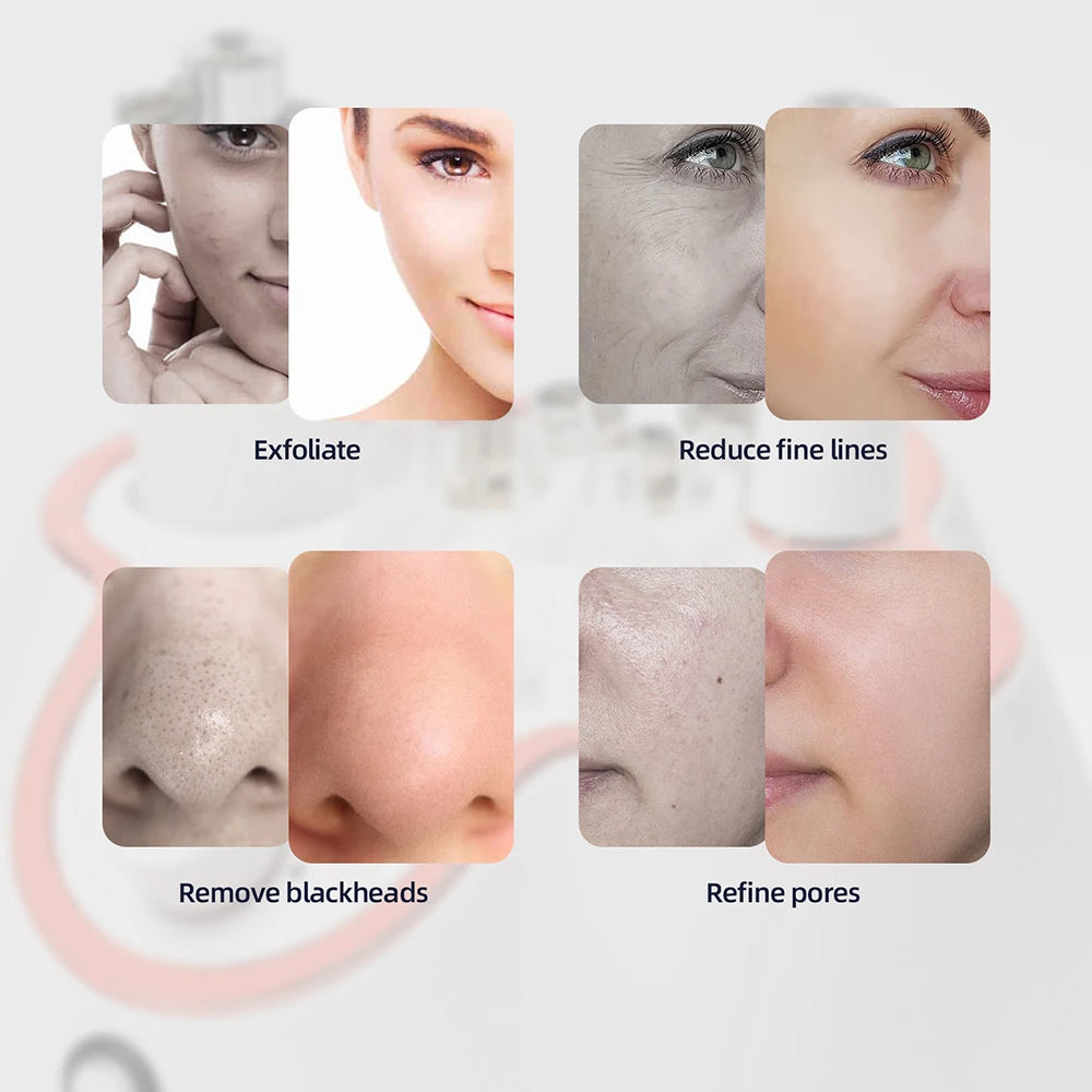 Professional 3-in-1 Diamond Microdermabrasion Facial Machine