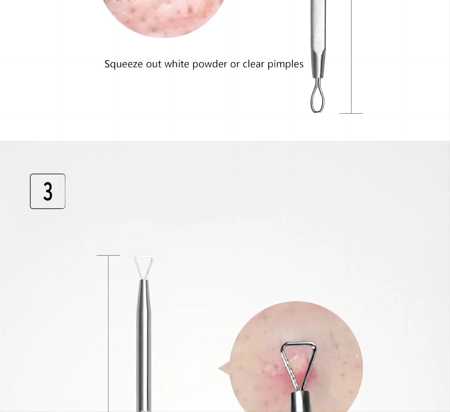 Professional Stainless Steel Blackhead Extractor & Pimple Popper Tool Kit - 14