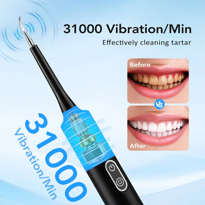 Electric Sonic Dental Calculus & Plaque Remover for Home Teeth Whitening