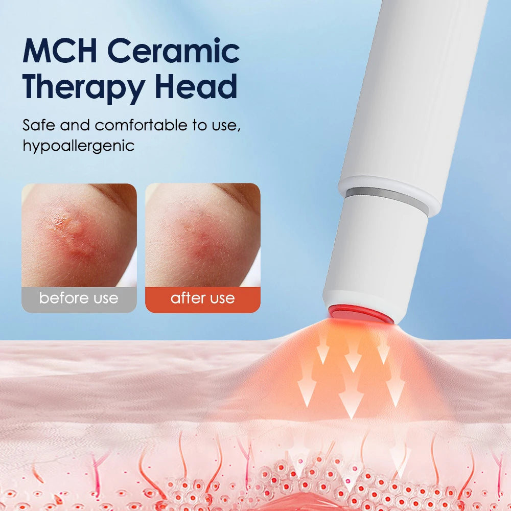 Electric Mosquito Bite Itch Relief Pen - Chemical-Free Soothing & Healing Device