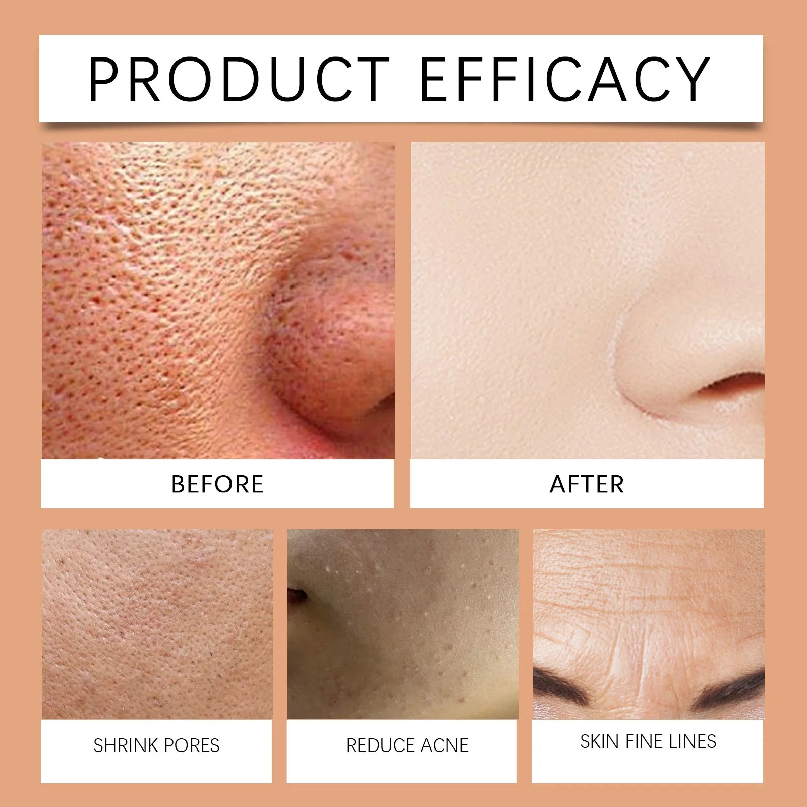 Orange Vitamin C Facial Exfoliating Gel for Deep Cleansing & Brightening - 4