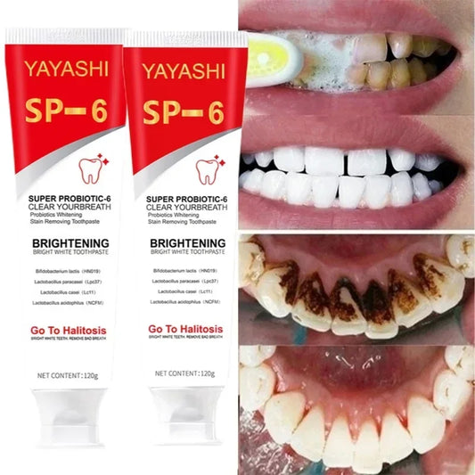 SP-6 Probiotic Teeth Whitening Toothpaste - Deep Stain Removal & Oral Care