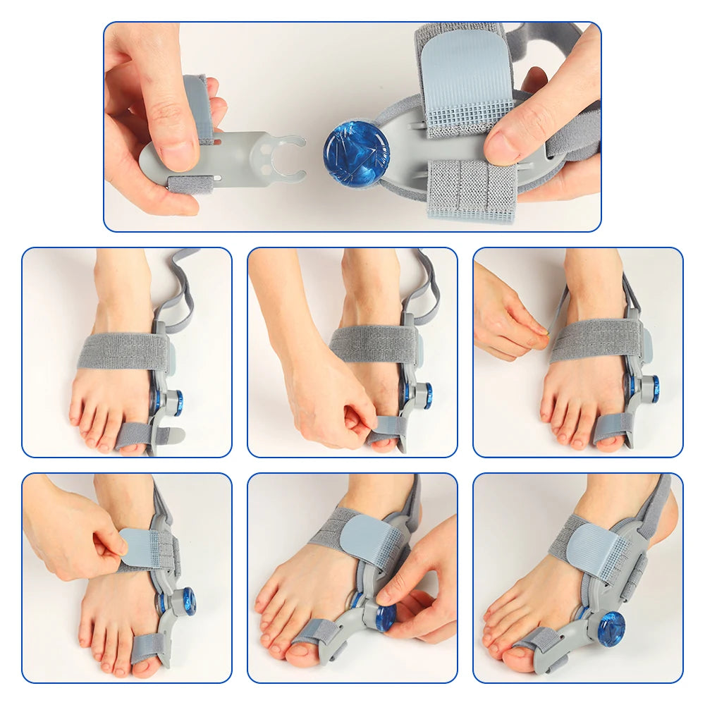 Adjustable Bunion Corrector & Toe Straightener Splint - 17