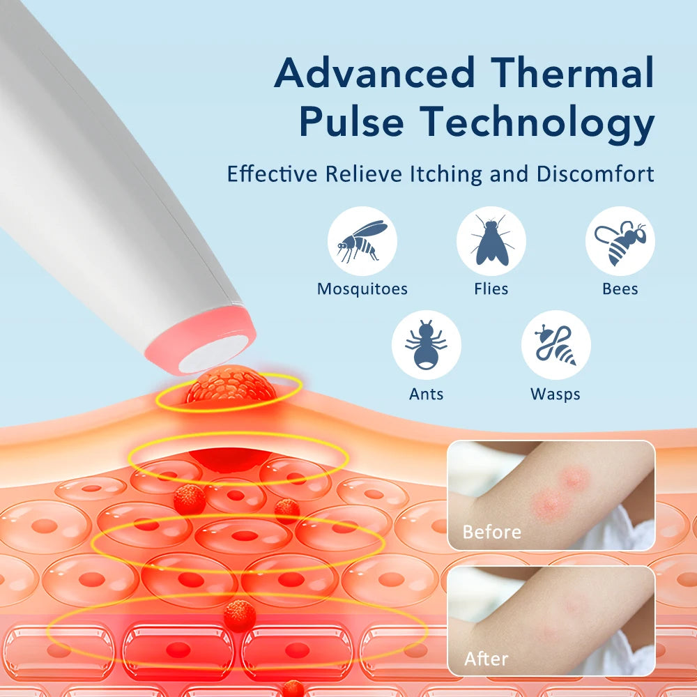 Electronic Insect Bite Itch Relief Pen - Portable Thermal Pulse Healing Tool - 5