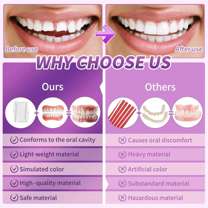 Comfort Fit Silicone Cosmetic Dentures - Natural Looking Instant Smile Veneers