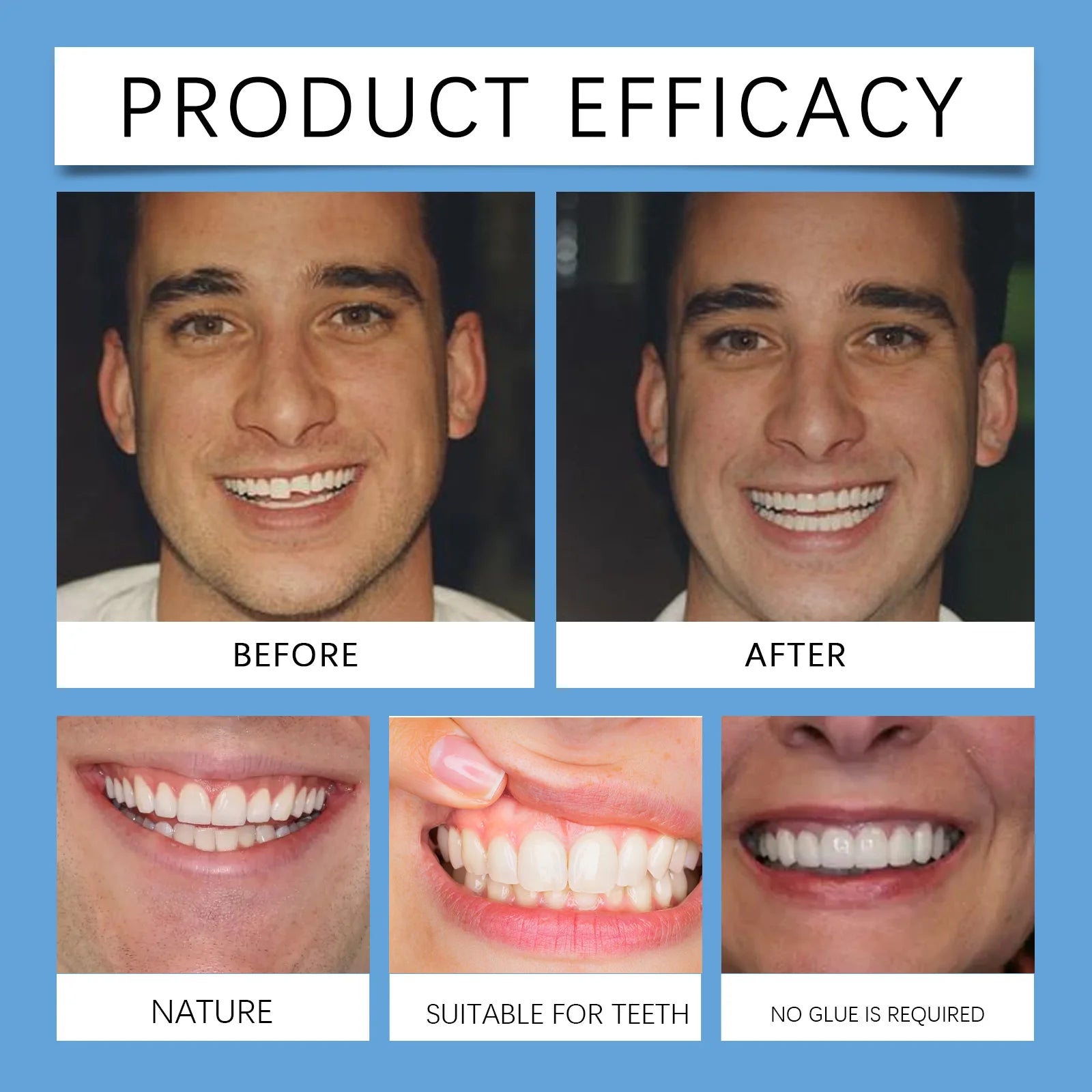 Snap-On Adjustable Smile Veneers for Instant Teeth Coverage and Whitening - 18