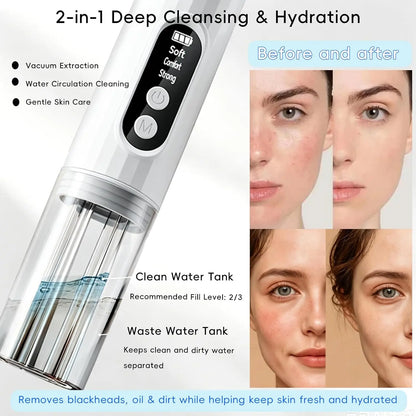 Electric Pore Vacuum Blackhead Remover with Hydration & Suction Facial Cleansing