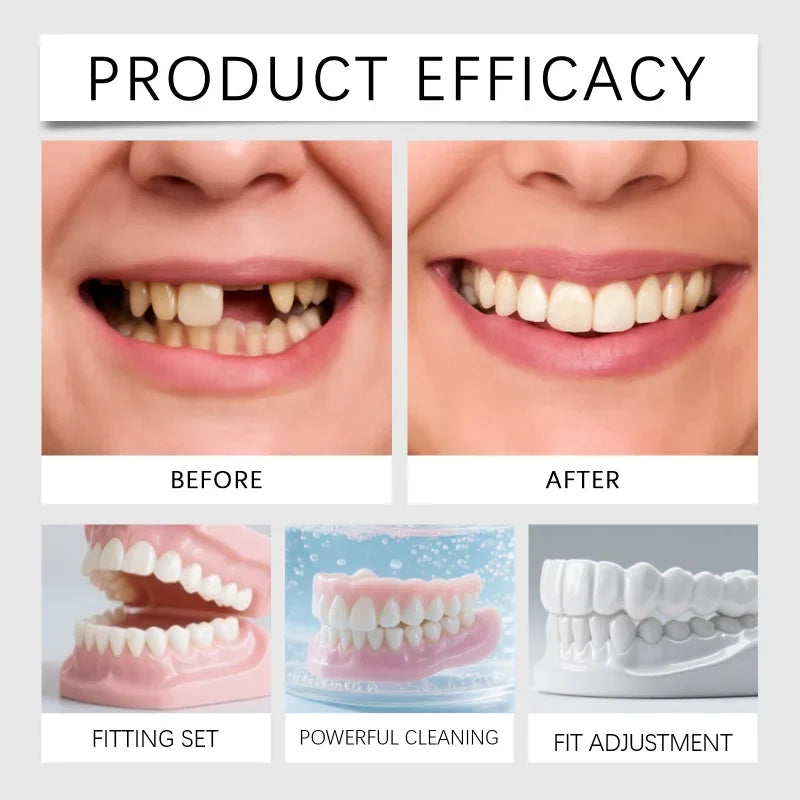 Premium Cosmetic Temporary Dentures - Comfortable Snap-On Smile for Missing Teeth