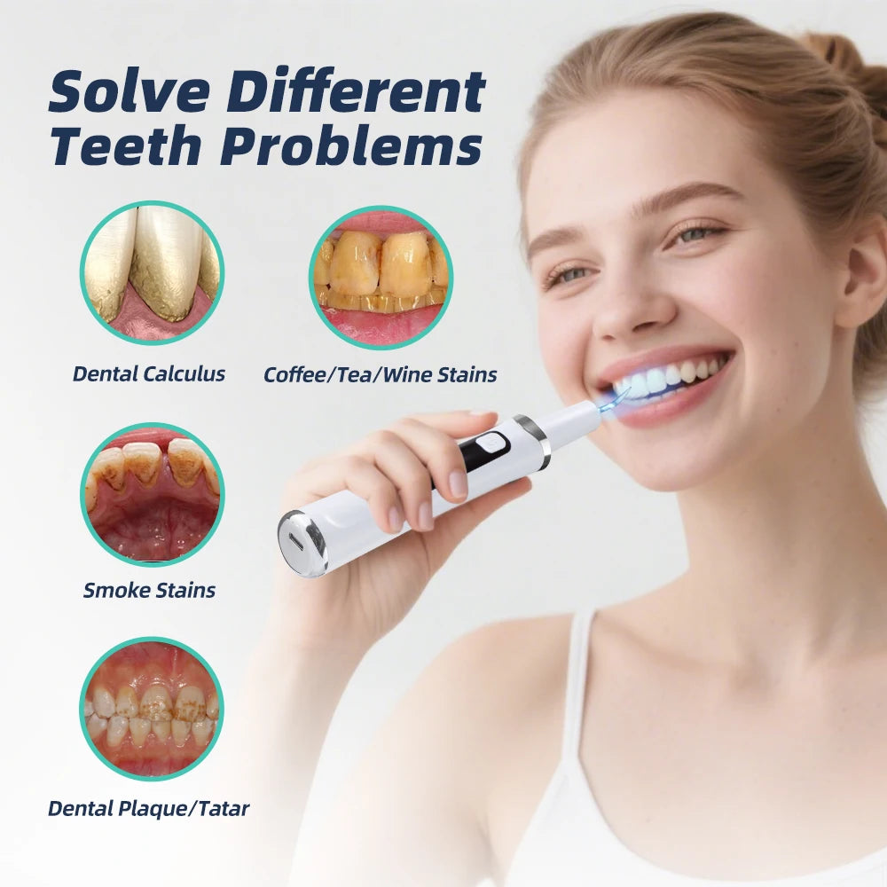 Ultrasonic Electric Teeth Cleaner & Tartar Remover for Professional Oral Care