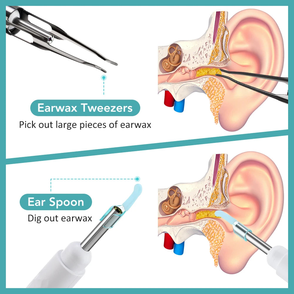 2-in-1 Visual Ear Wax Cleaner with HD Camera and Precision Tweezers - 9
