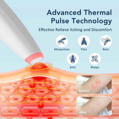 Electronic Insect Bite Itch Relief Pen - Portable Thermal Pulse Healing Tool