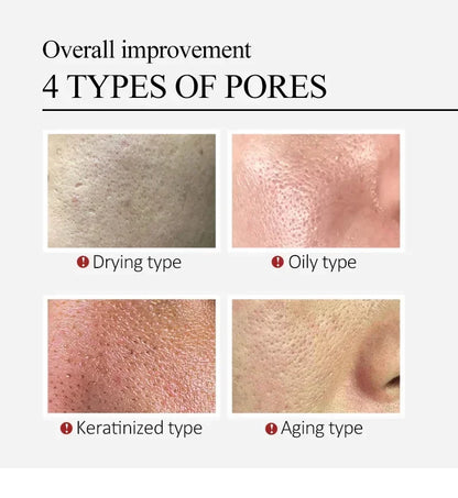 Salicylic Acid Pore Refining Cream - Acne Scar & Blackhead Treatment