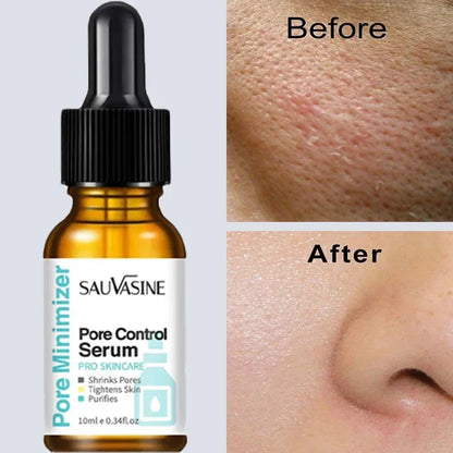 Pore Minimizing Facial Serum - Deep Pore Cleansing & Skin Tightening Treatment