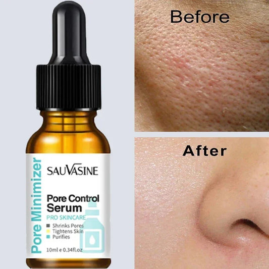 Pore Minimizing Facial Serum - Deep Pore Cleansing & Skin Tightening Treatment