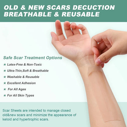 Silicone Scar Removal Tape - Waterproof, Reusable Adhesive Gel Sheet for Scar Repair