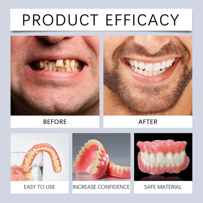Flexible Silicone Cosmetic Denture Reline Set for Instant Smile Transformation