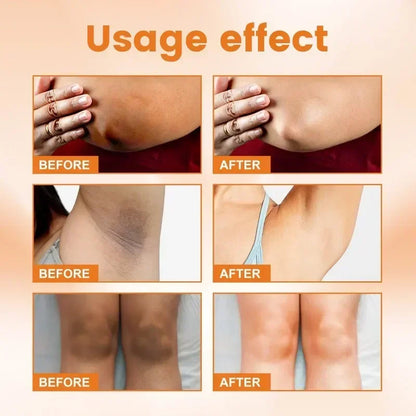 Vitamin C Brightening Cream for Dark Spots, Underarms, Elbows and Knees