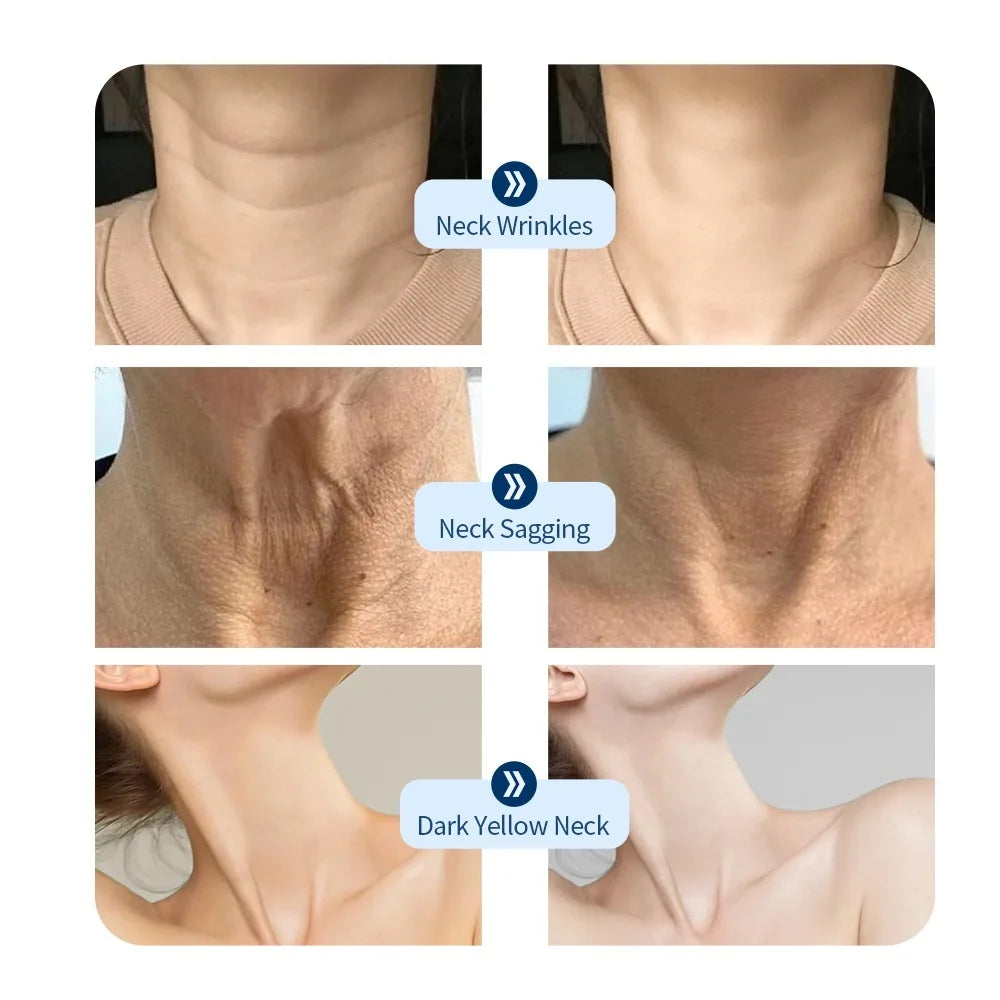 7-Color LED Neck Mask - Anti-Wrinkle & Skin Firming - 18