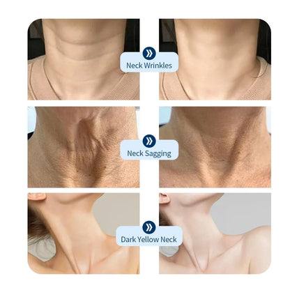 7-Color LED Neck Mask - Anti-Wrinkle & Skin Firming