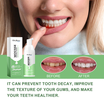 Whitening Foam Toothpaste for Deep Cleaning, Tartar Removal & Fresh Breath