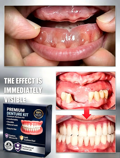 Premium Silicone False Teeth Kit - Natural Smile Cosmetic Denture