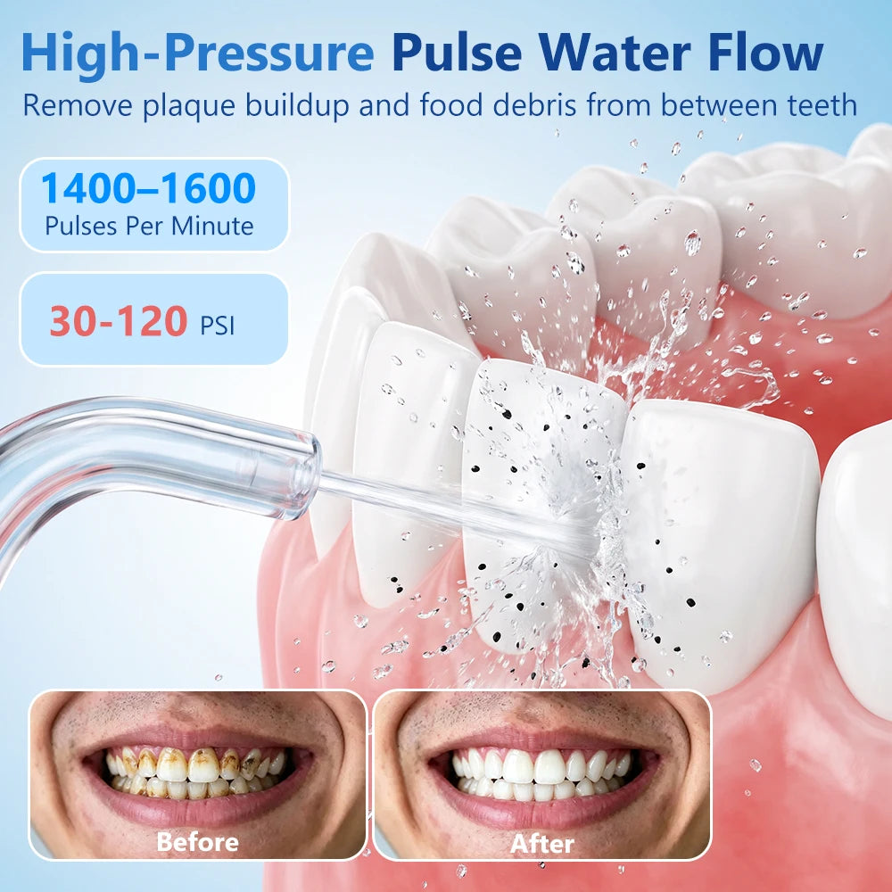 Rechargeable Portable Oral Irrigator Water Flosser for Deep Teeth Cleaning