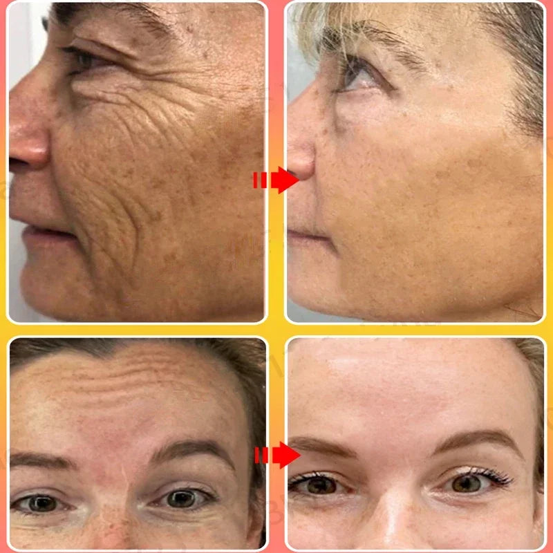 Anti-Aging Face Cream for Instant Wrinkle Removal & Skin Firming - 8
