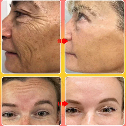 Anti-Aging Face Cream for Instant Wrinkle Removal & Skin Firming