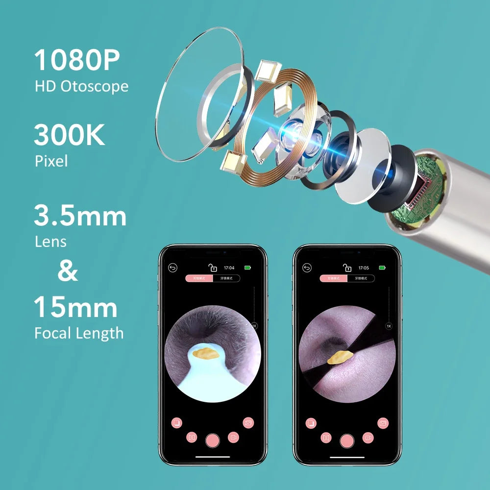 2-in-1 Visual Ear Wax Cleaner with HD Camera and Precision Tweezers - 3
