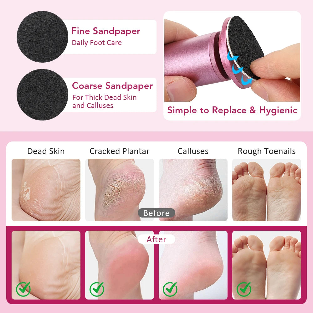 Electric Callus Remover for Feet - Professional Pedicure Foot File with 20 Discs - 4