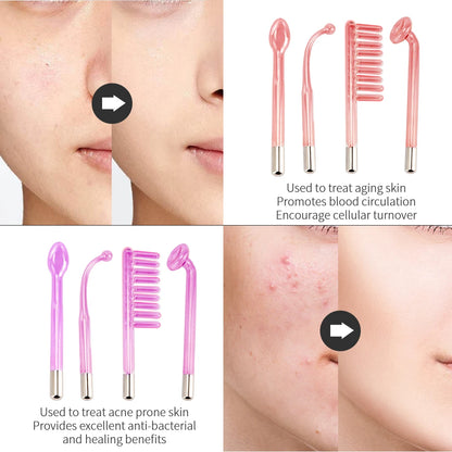 4-in-1 High Frequency Facial Therapy Wand for Acne