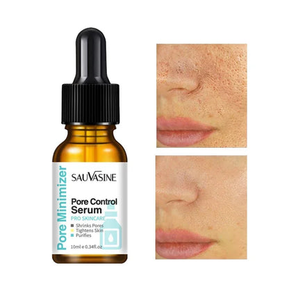 Pore Minimizing Facial Serum - Deep Pore Cleansing & Skin Tightening Treatment