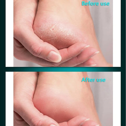 Professional Stainless Steel Foot File for Pedicure & Cracked Heel Removal
