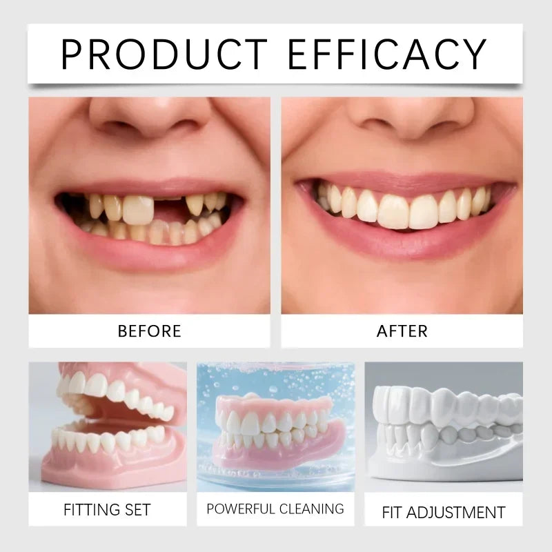 Premium Temporary Smile Veneers - Comfortable Fit for Missing or Chipped Teeth - 5