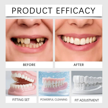 Premium Temporary Smile Veneers - Comfortable Fit for Missing or Chipped Teeth