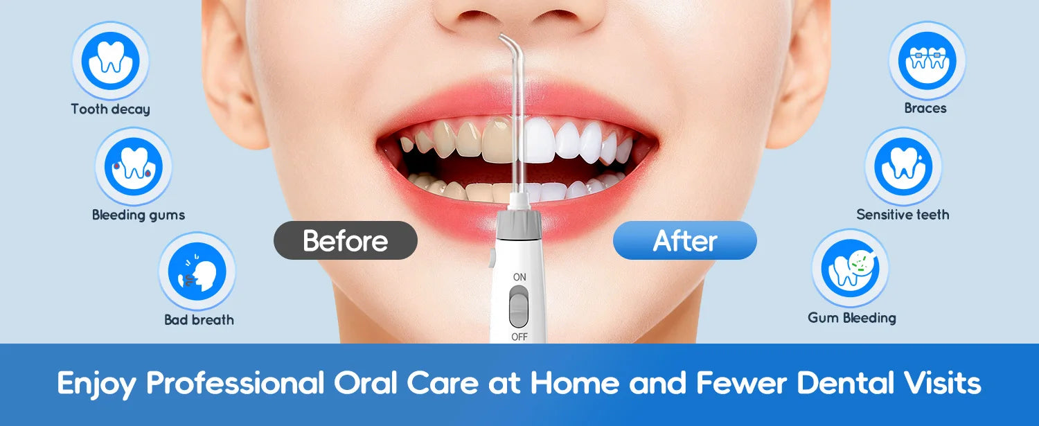 Professional Electric Oral Irrigator Water Flosser with 8 Nozzle Heads - 8