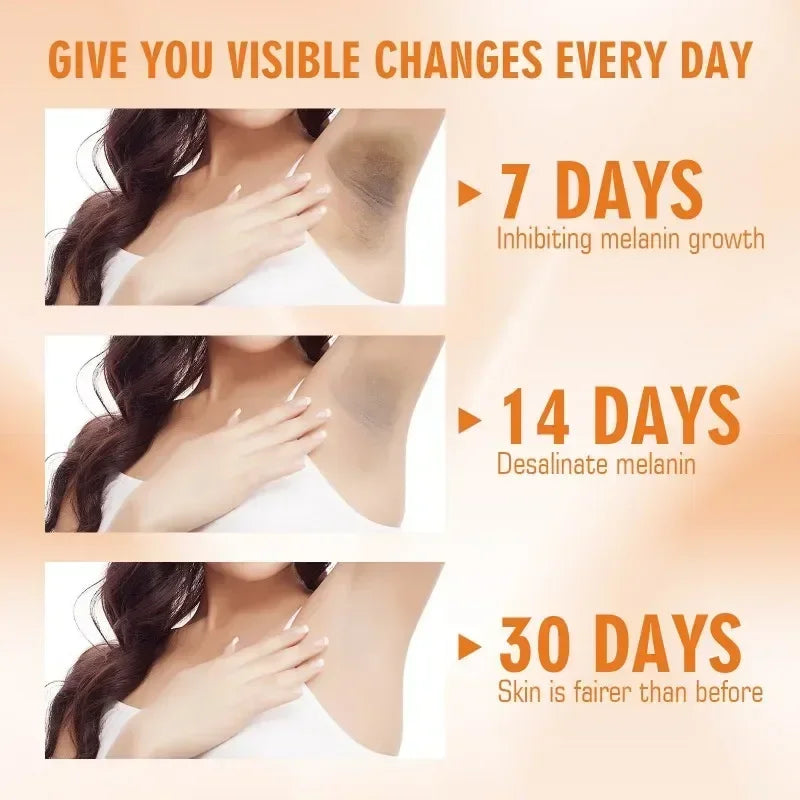 Vitamin C Brightening Cream for Dark Spots, Underarms, Elbows and Knees