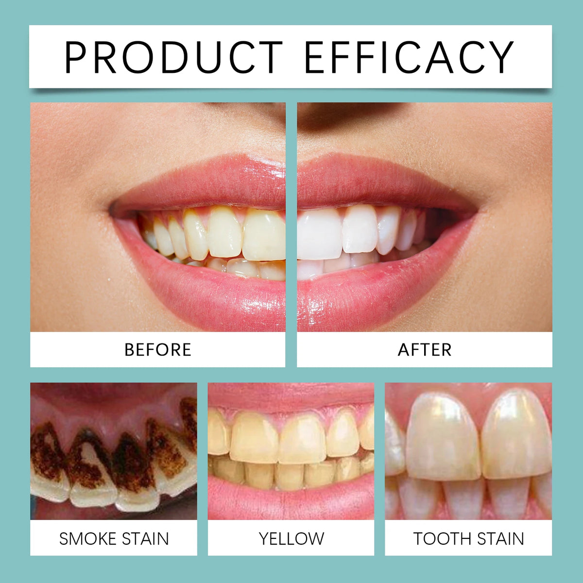 Instant Teeth Whitening Paint Gel for Stain Removal and Bright Smile