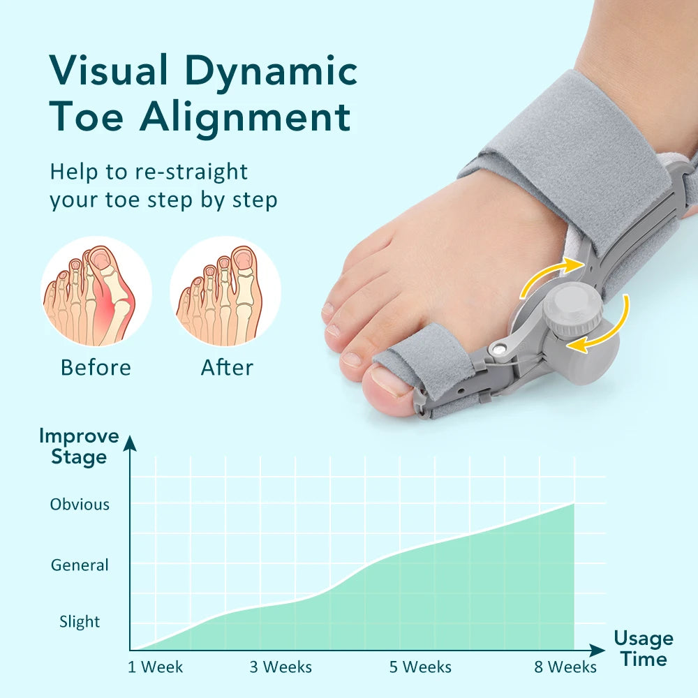 Adjustable Bunion Corrector & Big Toe Straightener for Pain Relief - 16
